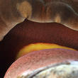hřib kovář (Neoboletus luridiformis)